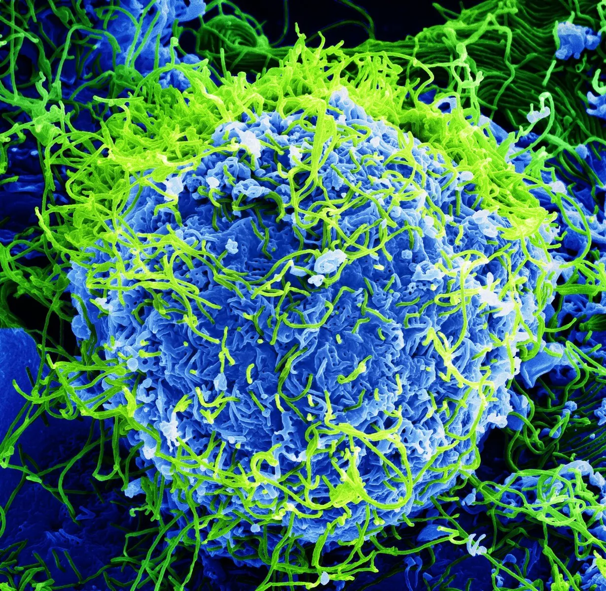 Micrografia eletrônica de varredura colorizada de partículas do vírus Ebola (em verde) saindo de uma célula infectada, em imagem de 2014.